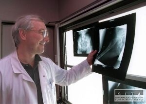 Vedci odhalili spojitos medzi celiakiou a osteoporzou